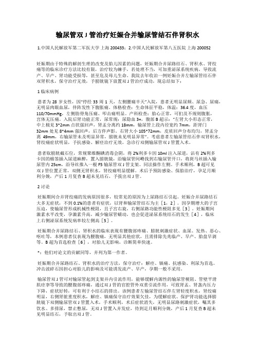 输尿管双J管治疗妊娠合并输尿管结石伴肾积水