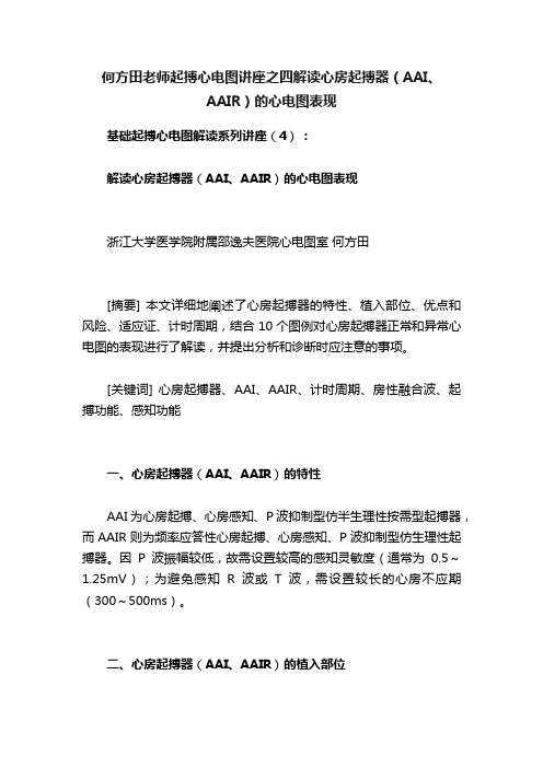 何方田老师起搏心电图讲座之四解读心房起搏器（AAI、AAIR）的心电图表现