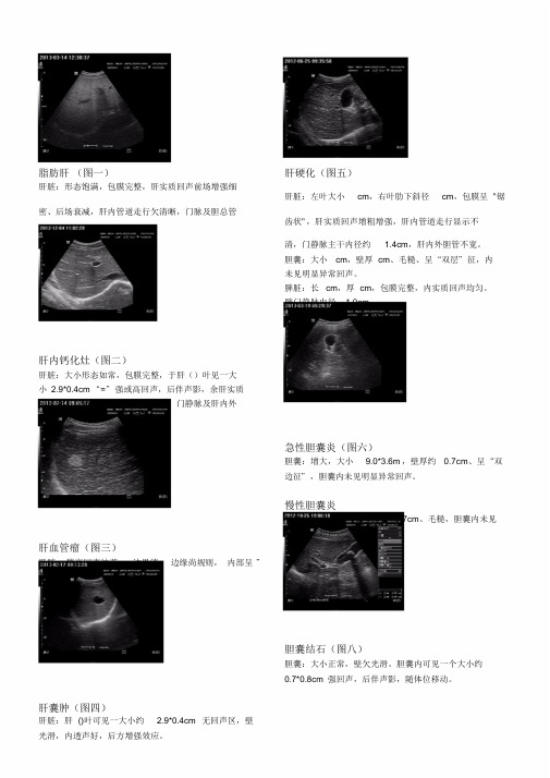 超声诊断报告描述及图片