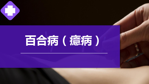 百合病(癔病),针灸治疗学课件