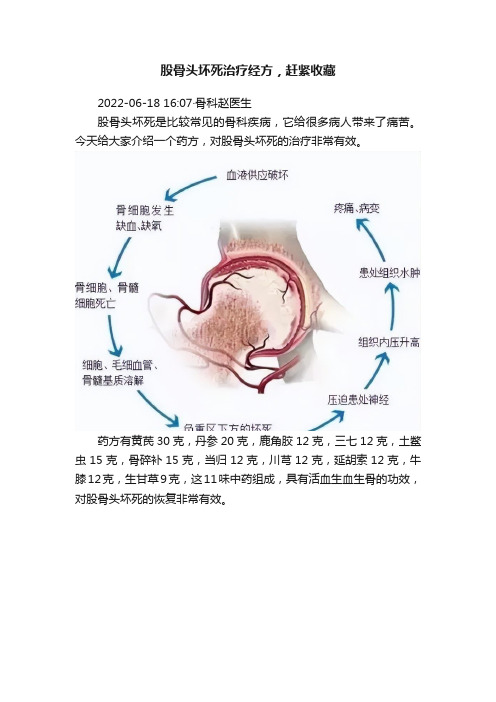 股骨头坏死治疗经方，赶紧收藏