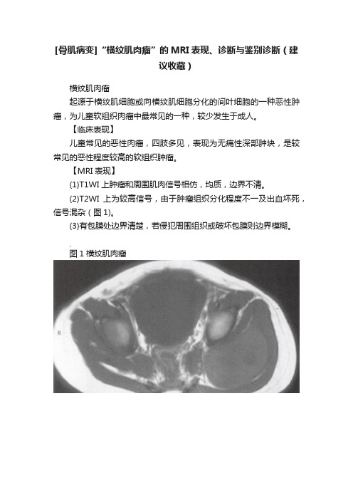 [骨肌病变]“横纹肌肉瘤”的MRI表现、诊断与鉴别诊断（建议收藏）