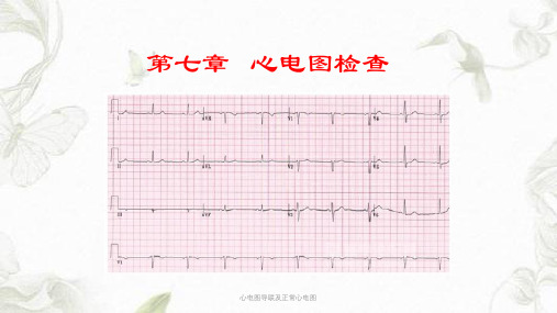 心电图导联及正常心电图ppt课件