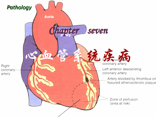 病理学(第八版)最新课件心血管系统疾病