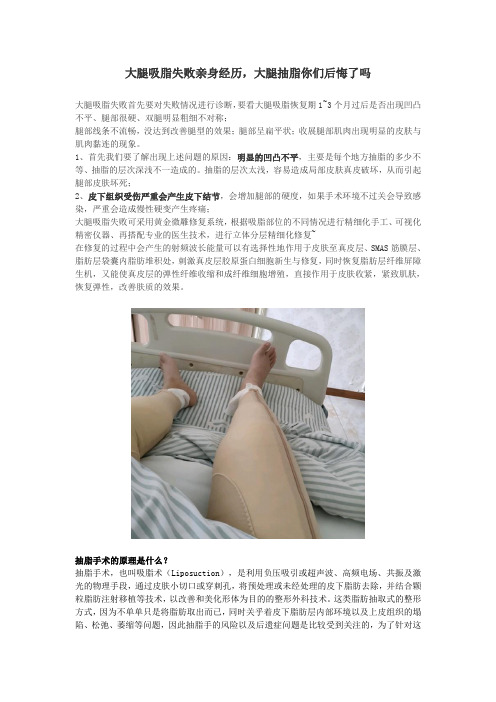 大腿吸脂失败亲身经历,大腿抽脂你们后悔了吗