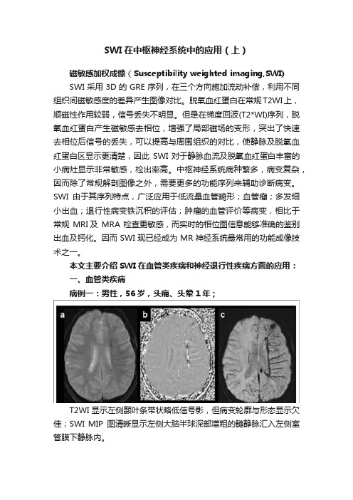 SWI在中枢神经系统中的应用（上）