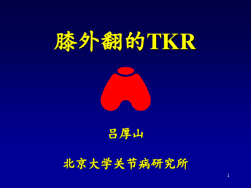 (参考课件)膝外翻畸形的TKR(新)