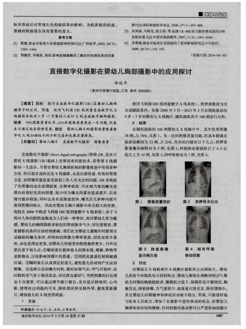 直接数字化摄影在婴幼儿胸部摄影中的应用探讨