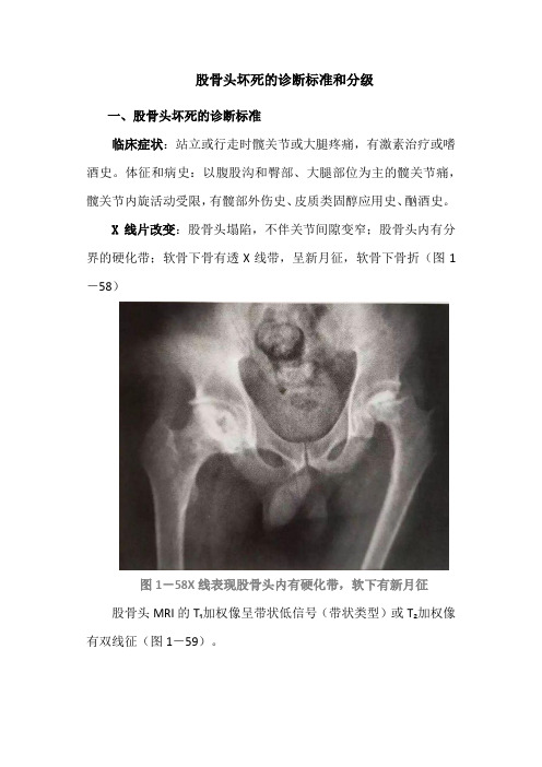 股骨头坏死的诊断标准和分级