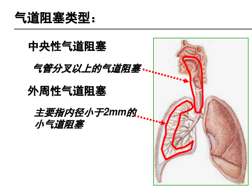 外周性气道阻塞ppt课件