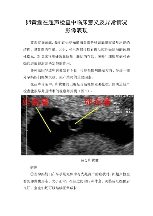 卵黄囊在超声检查中临床意义及异常情况影像表现