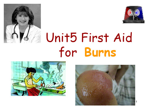 book5 Unit5 First Aid  for  Burns课文ppt课件