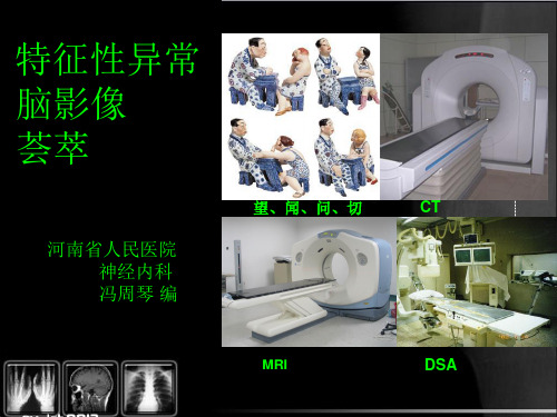 颅脑疾病征象学大全