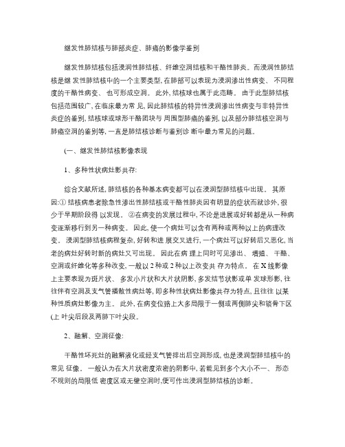 继发性肺结核与肺部炎症、肺癌的影像学鉴别讲解