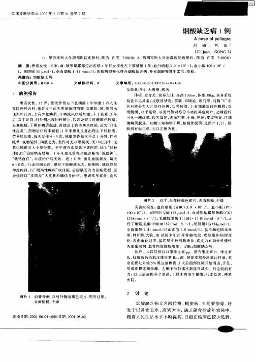 烟酸缺乏病1例