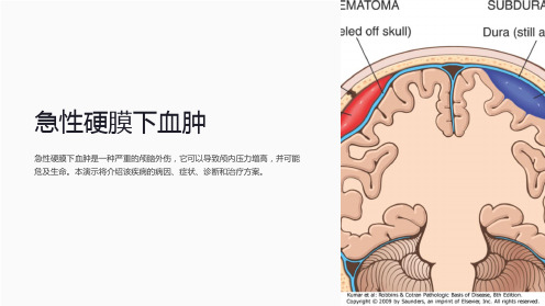 急性硬膜下血肿