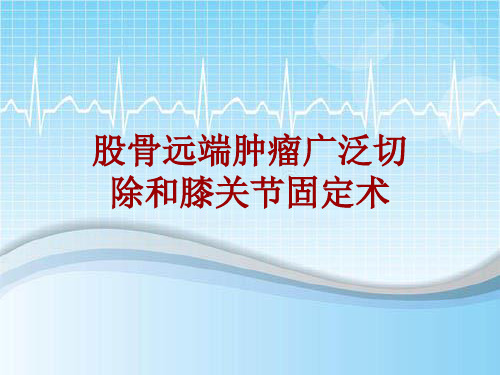 手术讲解模板:股骨远端肿瘤广泛切除和膝关节固定术