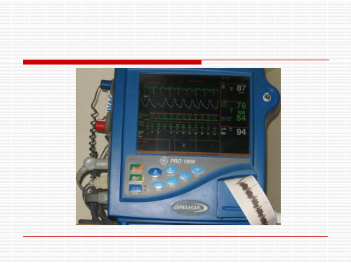 心电监护(多功能)ppt课件
