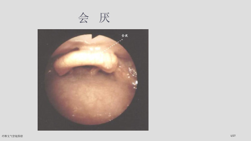 纤维支气管镜图谱