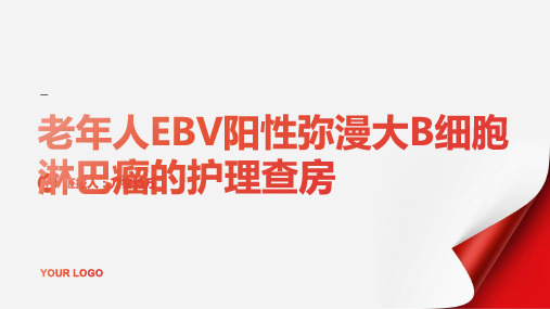 老年人EBV阳性弥漫大B细胞淋巴瘤的护理查房