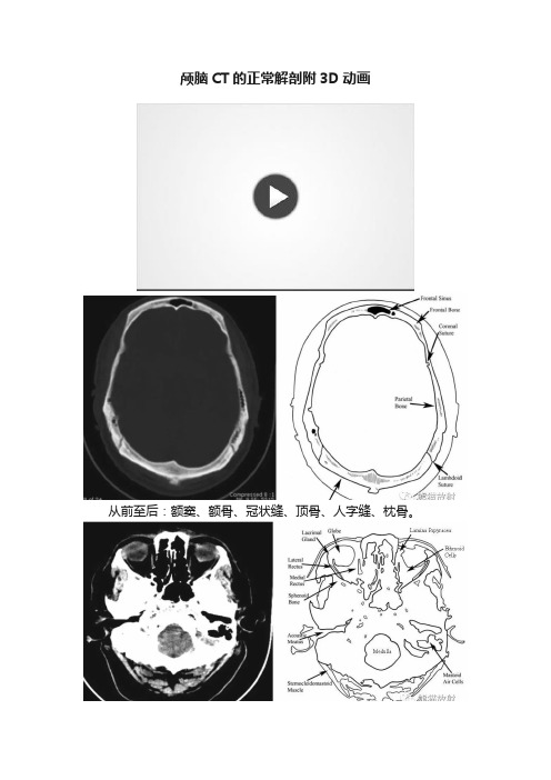 颅脑CT的正常解剖附3D动画