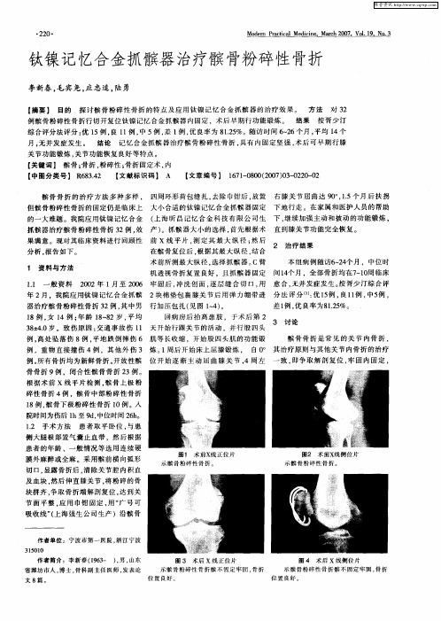 钛镍记忆合金抓髌器治疗髌骨粉碎性骨折