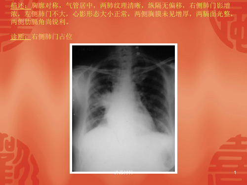 常见40张X片读片及诊断行业特制