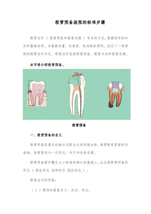 根管预备流程的标准步骤