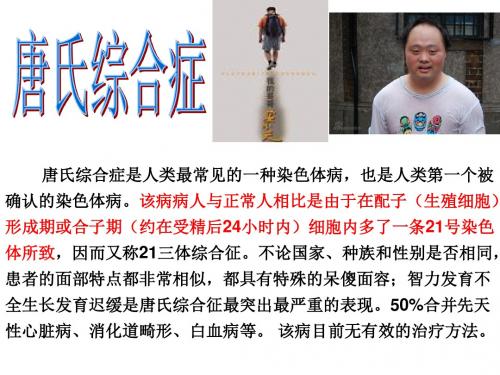 生物:2.1《减数分裂中的染色体行为》课件(浙科版必修2)(2)