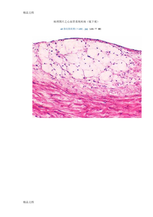 (整理)心血管系统疾病镜下观