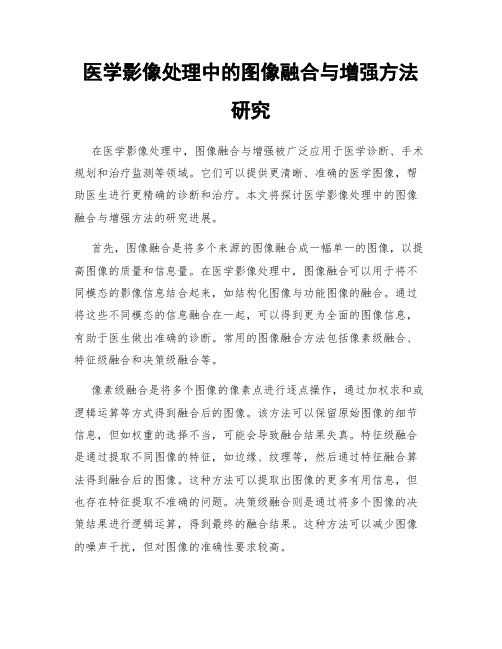 医学影像处理中的图像融合与增强方法研究