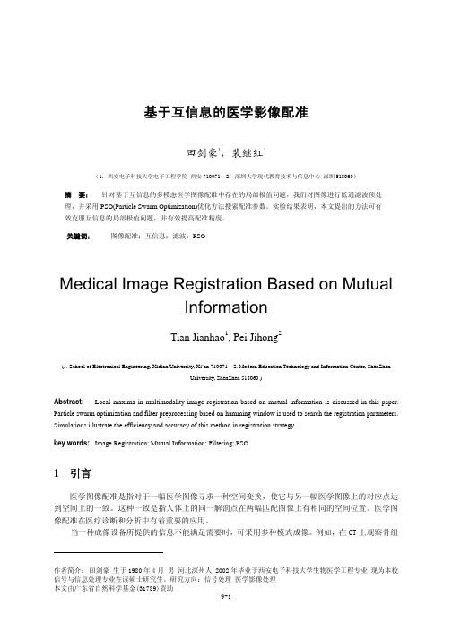 基于互信息的医学影像配准