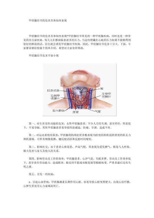 甲状腺结节的危害具体如何表现