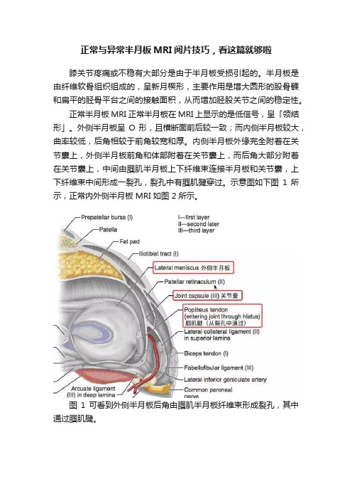 正常与异常半月板MRI阅片技巧，看这篇就够啦