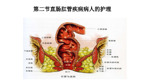 直肠肛管疾病病人的护理