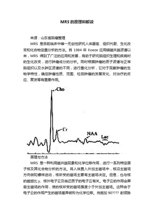 MRS的原理和解读