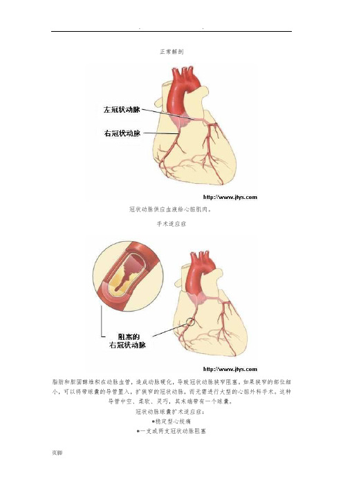 球囊扩张术