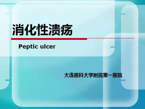 消化性溃疡PPT课件