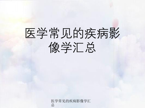 医学常见疾病影像学汇总