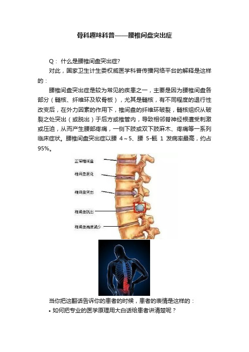 骨科趣味科普——腰椎间盘突出症