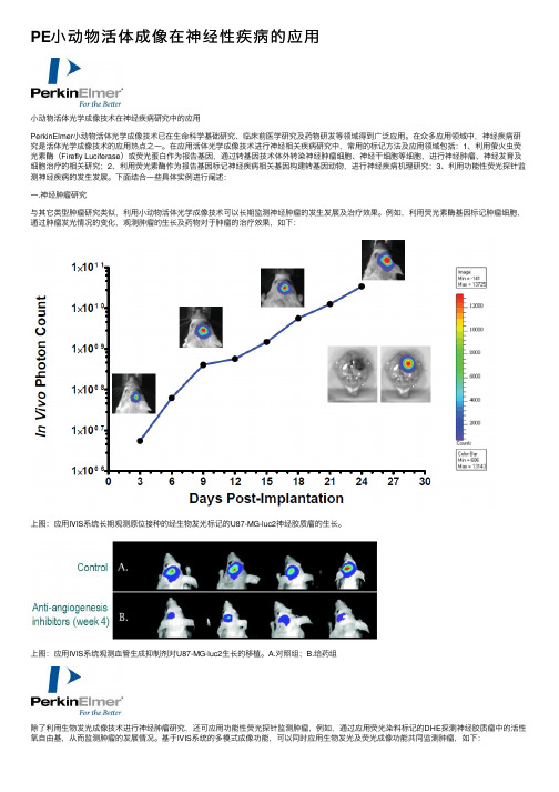 PE小动物活体成像在神经性疾病的应用