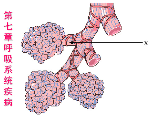 慢支炎肺气肿肺心病PPT课件