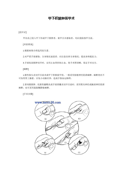 拔甲基本操作流程