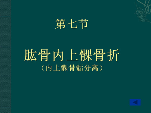 肱骨内上髁骨折