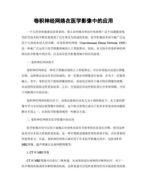 卷积神经网络在医学影像中的应用