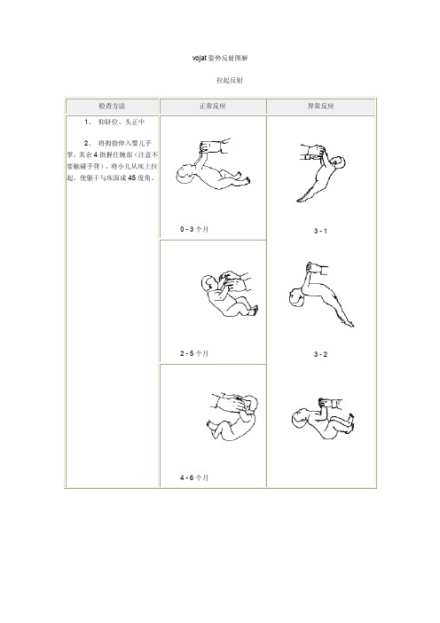 vojat姿势反射图解（精）