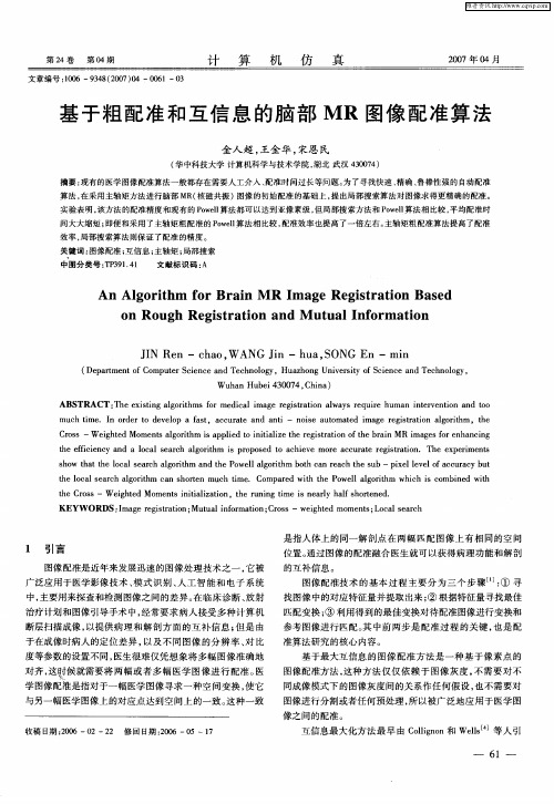 基于粗配准和互信息的脑部MR图像配准算法