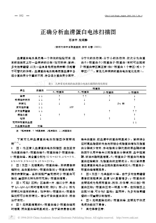 正确分析血清蛋白电泳扫描图