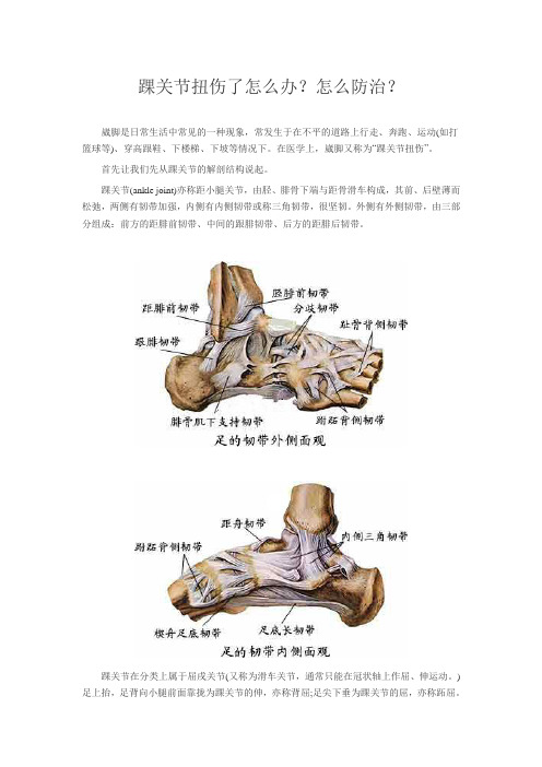 踝关节扭伤了怎么办？怎么防治？