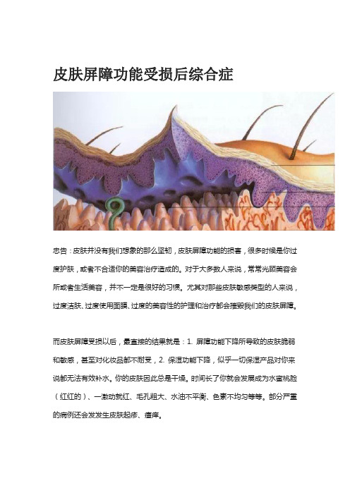 皮肤屏障功能受损后综合症